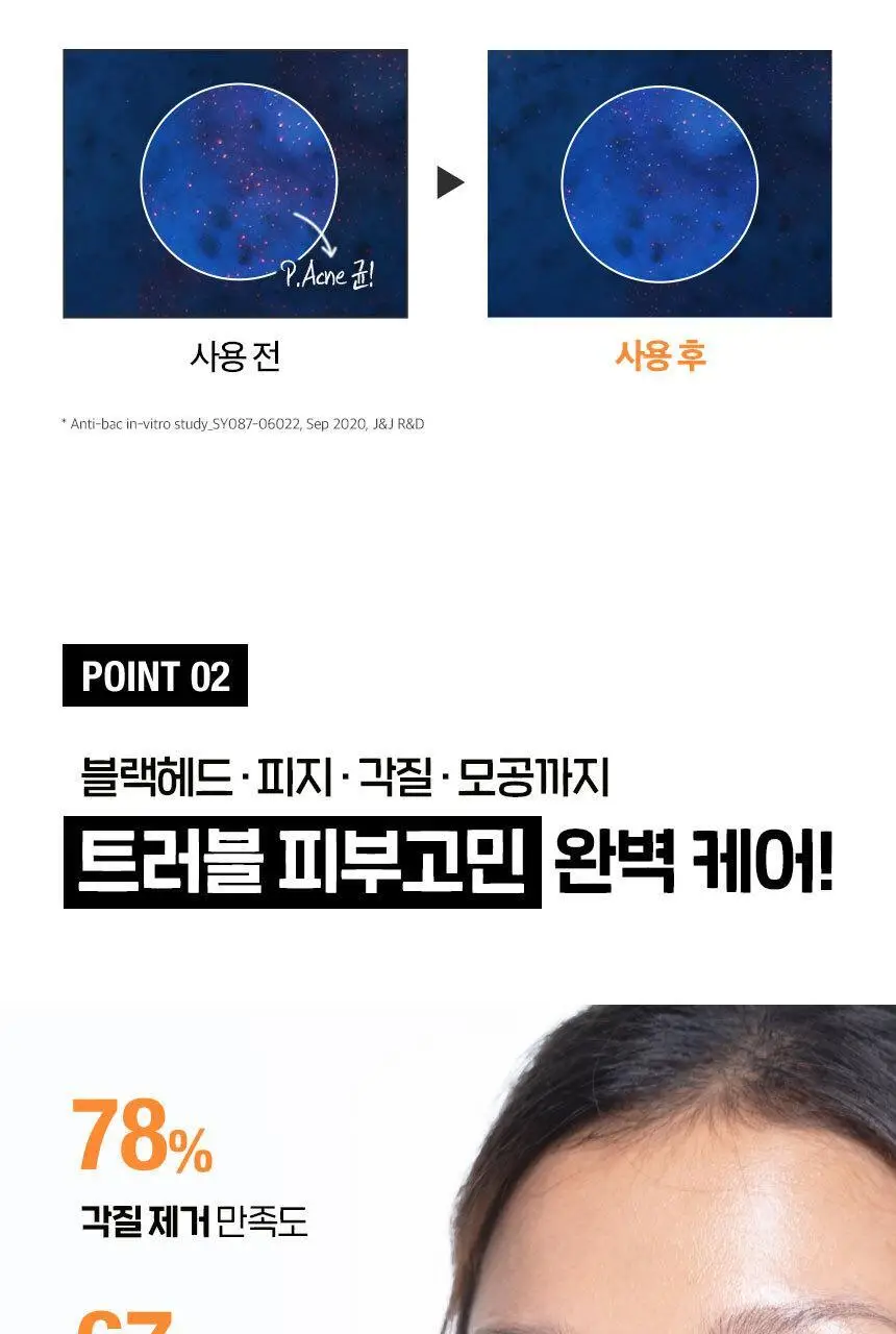 [매끈클린모공폼/트러블예방] 뉴트로지나 딥클린 아크네 포밍 클렌저 150g 기획(+100g) 상세페이지 10